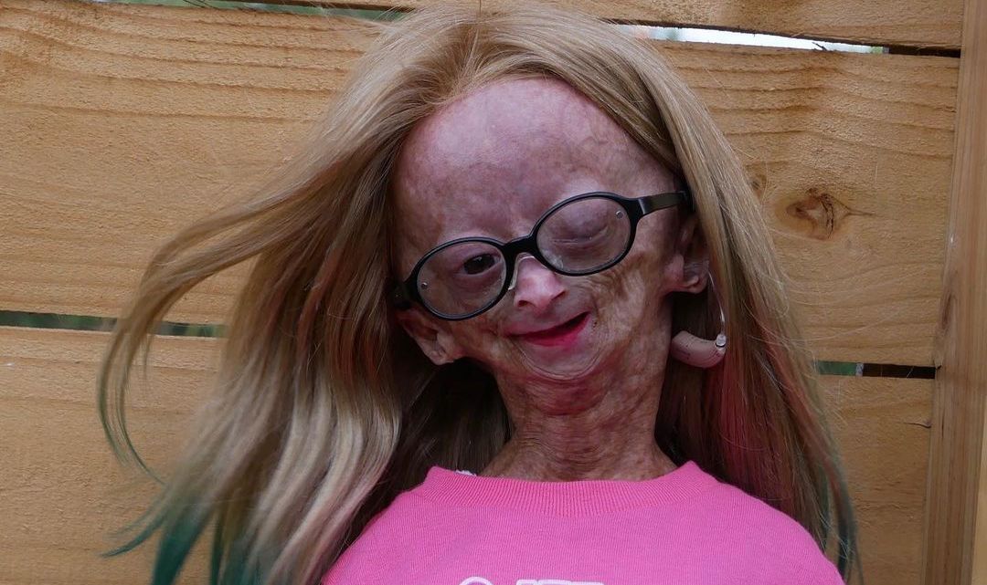 Adalia Rose