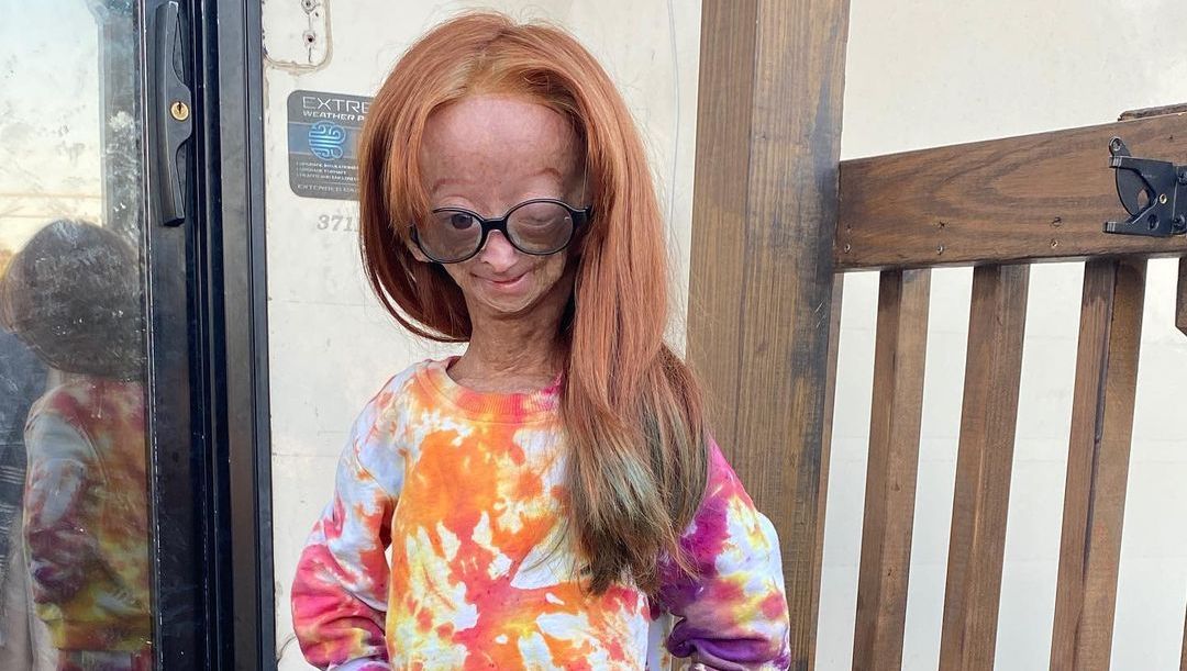 Adalia Rose