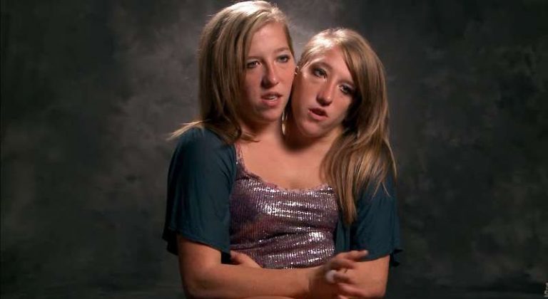 Where are Abby and Brittany Hensel in 2022? They are fifth-grade