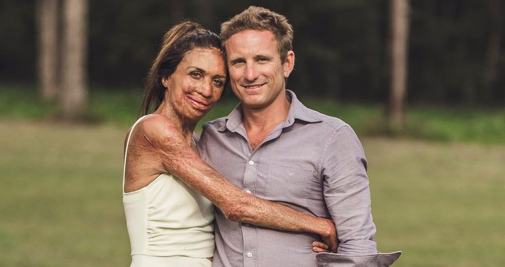 Turia Pitt and Michael Hoskin